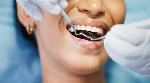 Best Emergency Wisdom Teeth Removal in Stuart, VA