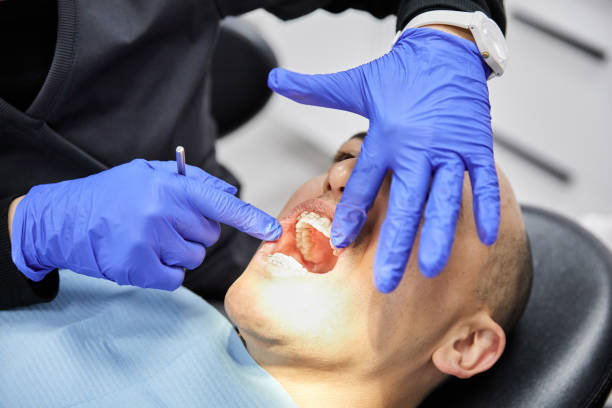 Best Emergency Tooth Extraction in Stuart, VA
