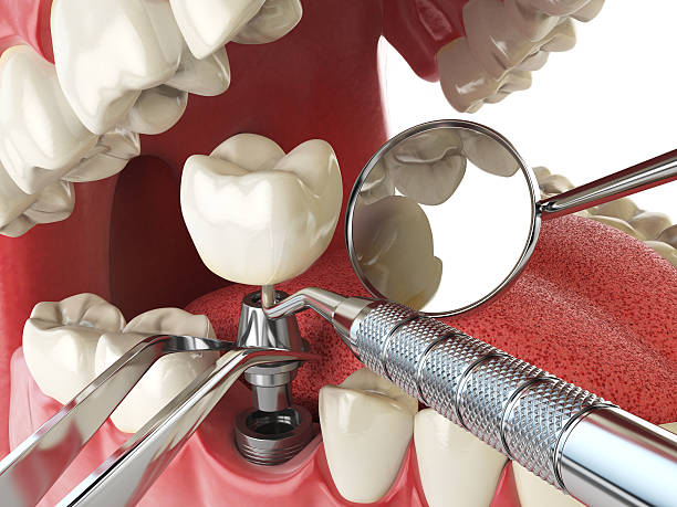 Best Emergency TMJ Treatment in Stuart, VA